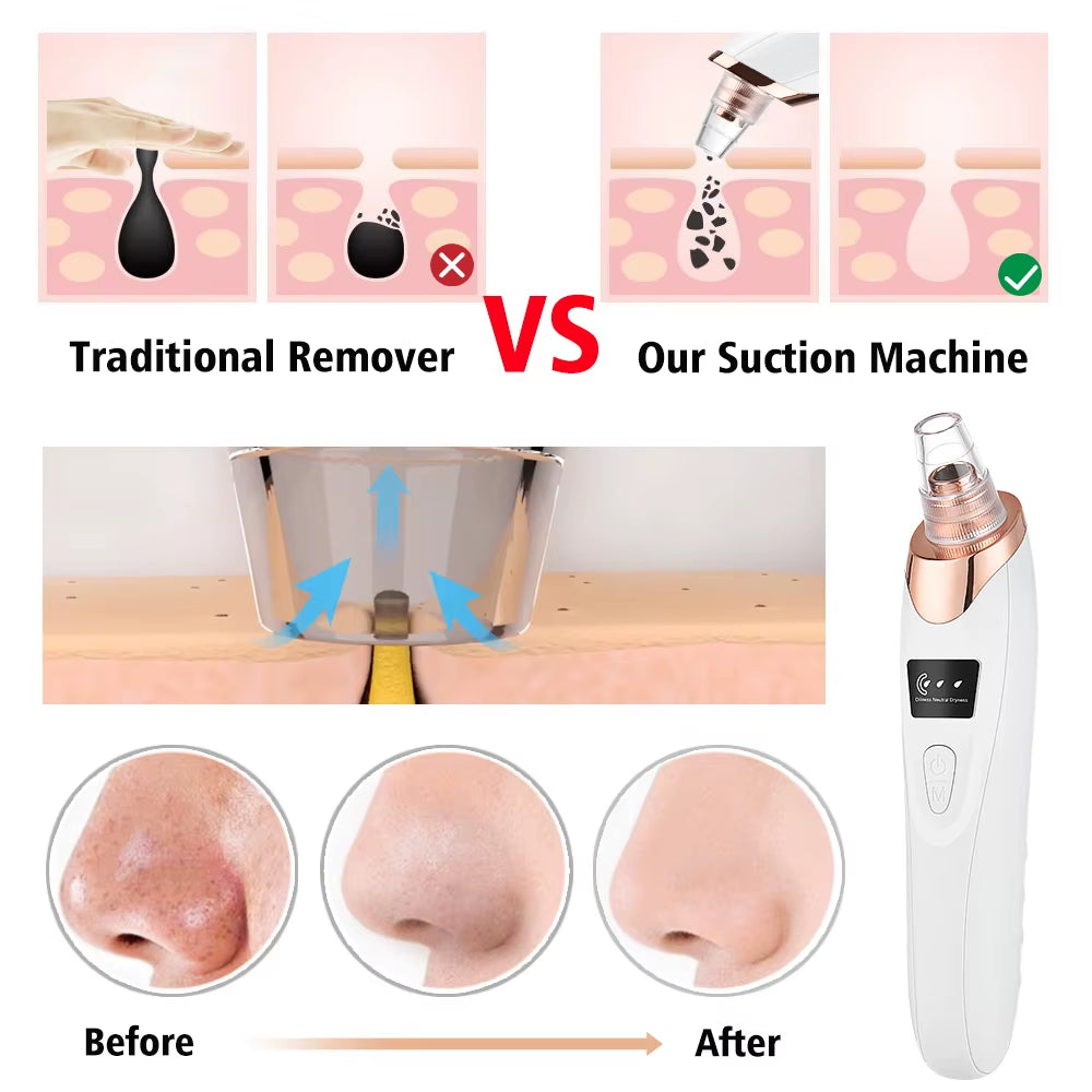 Facial Blackhead Remover Electric Acne Cleaner Blackhead Black Point Vacuum Cleaner Tool Black Spots Pore Cleaner Machine